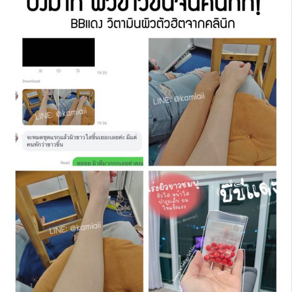 BBแดง ผิวขาว (วิตามินบีบีแดง) - Image 8