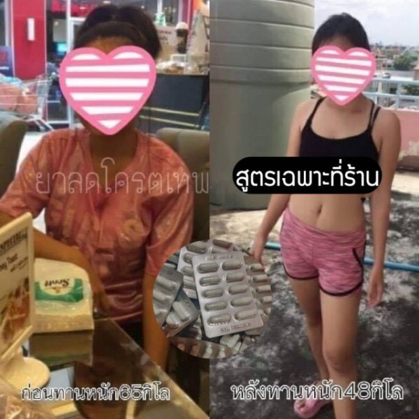 ยาลดโคตรเทพ 3-5กิโลต่อแผง - Image 7