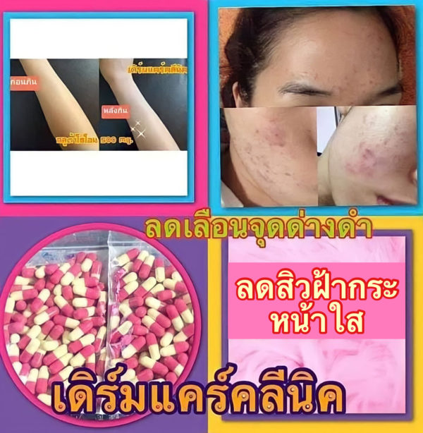 ยาขาวเดิมแคร์คลินิก Dermcare Clinic - Image 6