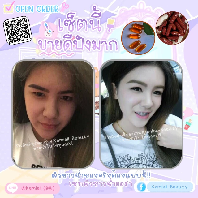 สั่งเซทตามรีวิว เซทผิวขาวเด้ง เร่งขาวไวหน้าเด็ก