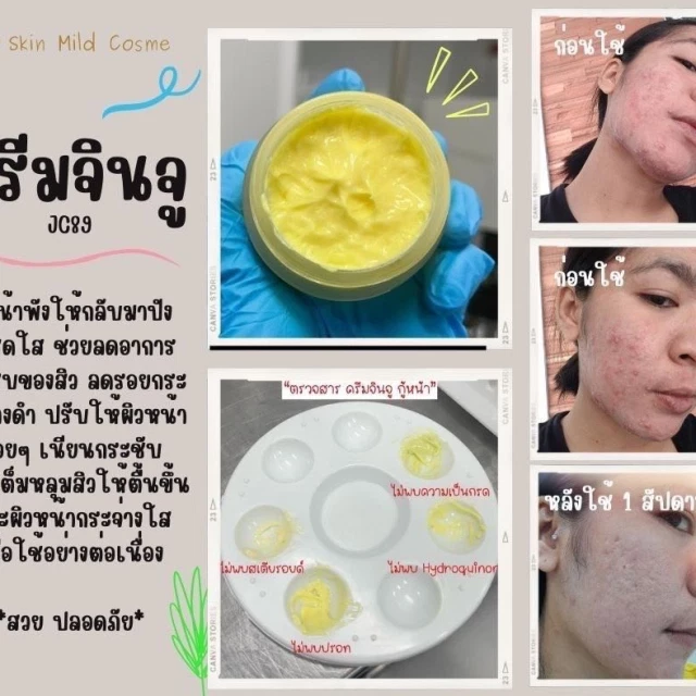 เทสขนาดทดลอง5กรัม ก่อนทำแบรนด์ ครีมจินจู กู้หน้าพัง หน้าแหก ลดสิวหน้าขาวใส