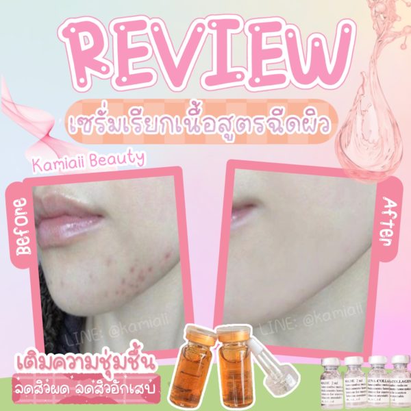 เทสเซรั่มเรียกเนื้อ สยบหลุมสิวฝ้ากระจุดด่างดำ หน้าเนียนใส - Image 2