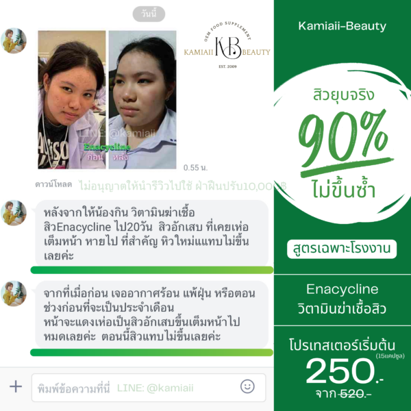 Enacycline วิตามินดูแลเรื่องสิวหน้าใส ลดสิว - Image 4