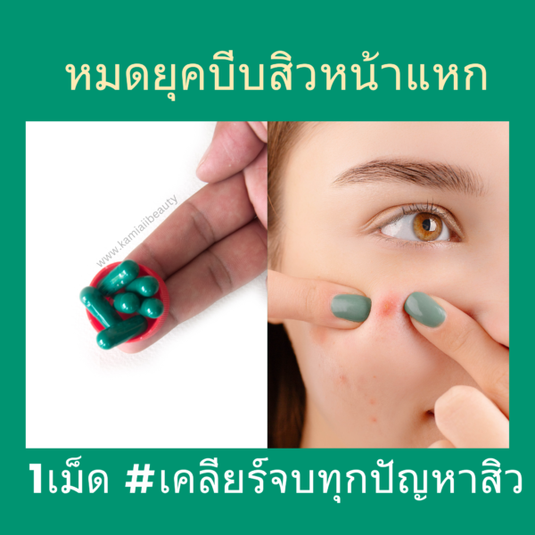 Enacycline วิตามินดูแลเรื่องสิวหน้าใส ลดสิว - Image 7