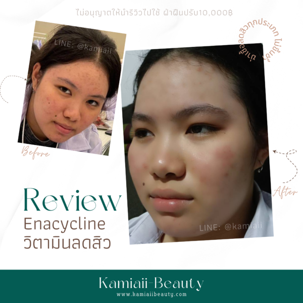 Enacycline วิตามินดูแลเรื่องสิวหน้าใส ลดสิว - Image 6