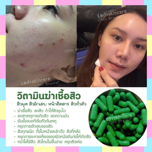 Enacycline วิตามินดูแลเรื่องสิวหน้าใส ลดสิว - Image 8