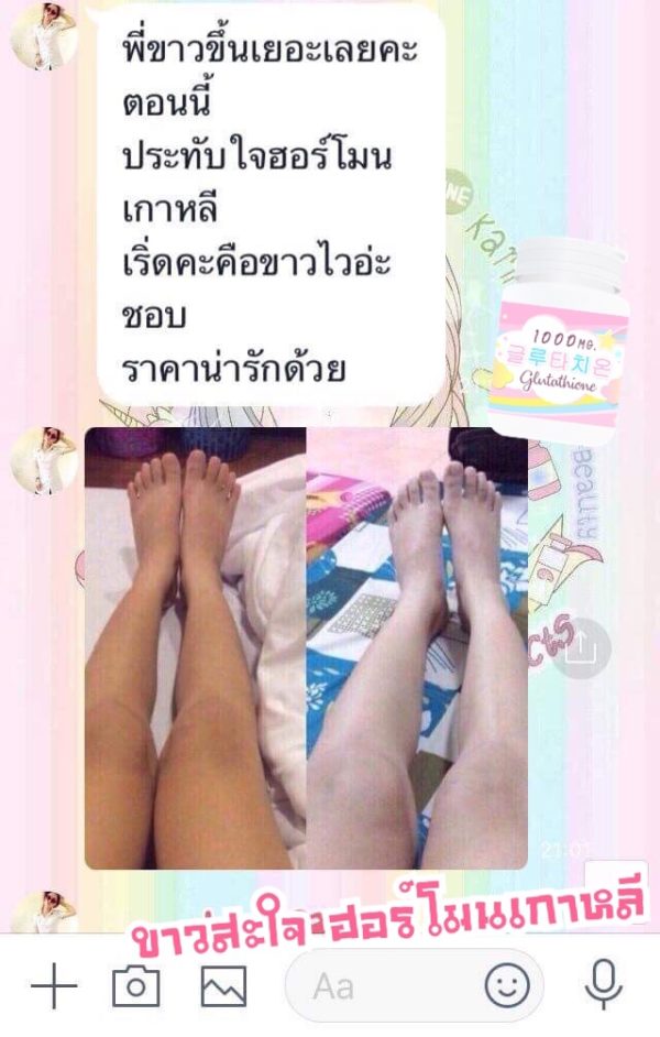 1แถม1🔥 วิตามินฮอร์โมนผิวขาวเกาหลี 피부 호르몬+ 글루타치온 1,000mg. - Image 33