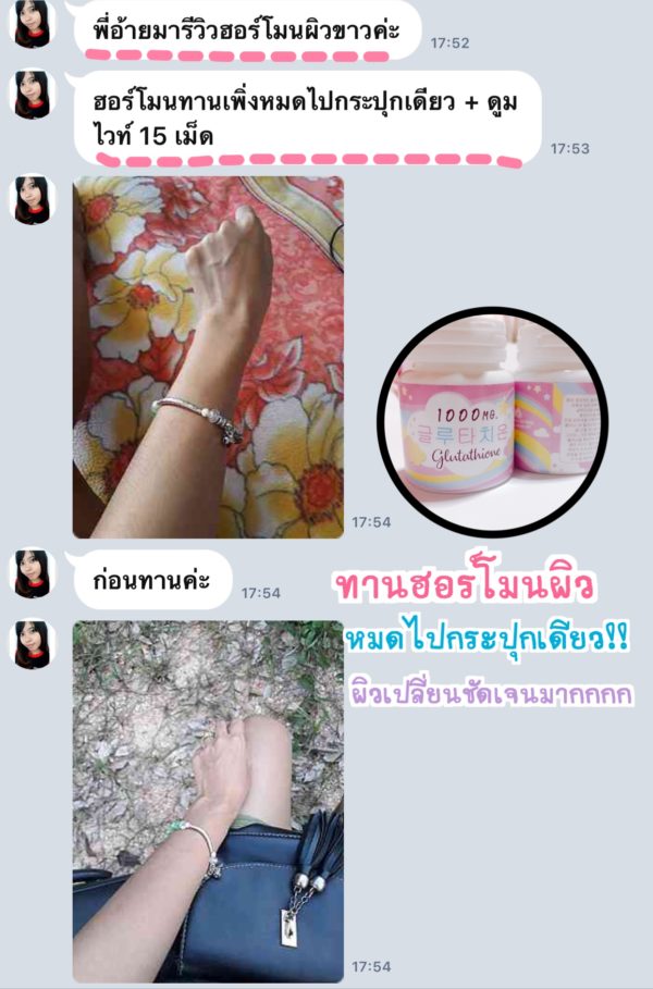 1แถม1🔥 วิตามินฮอร์โมนผิวขาวเกาหลี 피부 호르몬+ 글루타치온 1,000mg. - Image 25