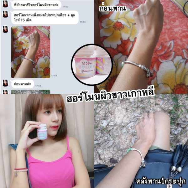 1แถม1🔥 วิตามินฮอร์โมนผิวขาวเกาหลี 피부 호르몬+ 글루타치온 1,000mg. - Image 8