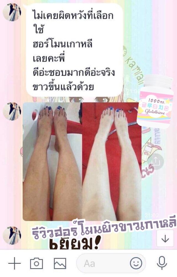 1แถม1🔥 วิตามินฮอร์โมนผิวขาวเกาหลี 피부 호르몬+ 글루타치온 1,000mg. - Image 37