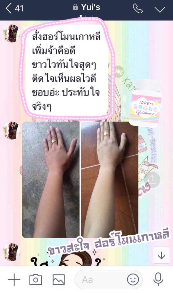 1แถม1🔥 วิตามินฮอร์โมนผิวขาวเกาหลี 피부 호르몬+ 글루타치온 1,000mg. - Image 36