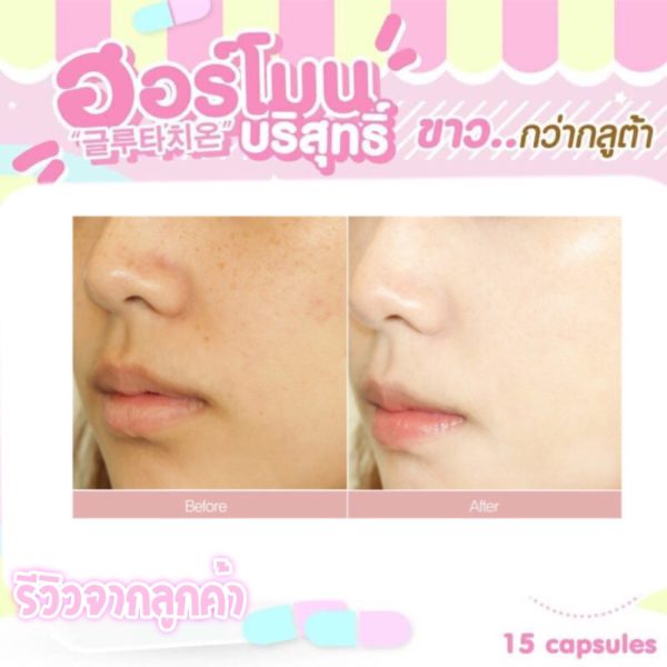 1แถม1🔥 วิตามินฮอร์โมนผิวขาวเกาหลี 피부 호르몬+ 글루타치온 1,000mg. - Image 9