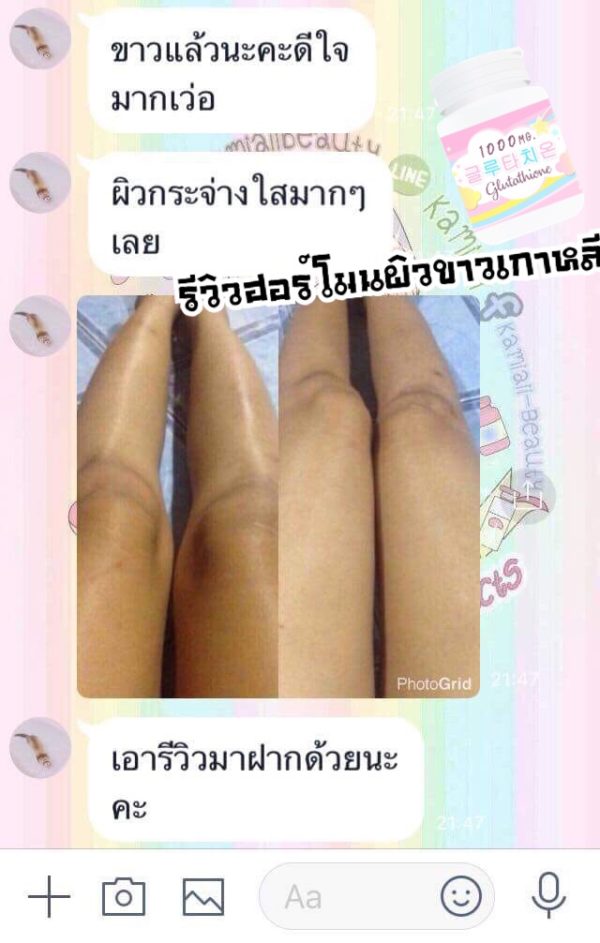 1แถม1🔥 วิตามินฮอร์โมนผิวขาวเกาหลี 피부 호르몬+ 글루타치온 1,000mg. - Image 38