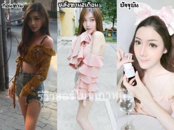 1แถม1🔥 วิตามินฮอร์โมนผิวขาวเกาหลี 피부 호르몬+ 글루타치온 1,000mg. - Image 27