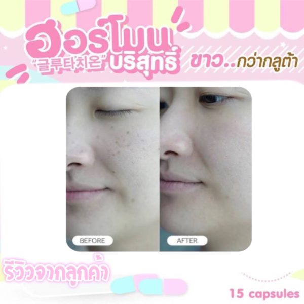 1แถม1🔥 วิตามินฮอร์โมนผิวขาวเกาหลี 피부 호르몬+ 글루타치온 1,000mg. - Image 10