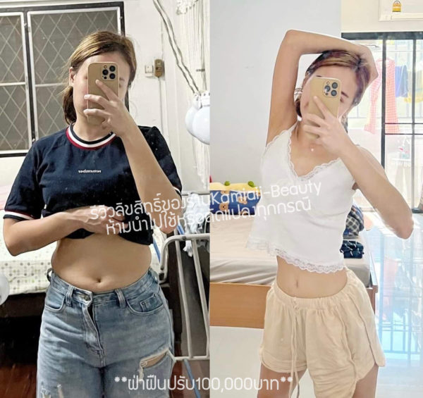 ลดX20 Premium แบบแผง 1แผง ลดแรงสุด ดื้อยาขั้นสุดท้าย - Image 8