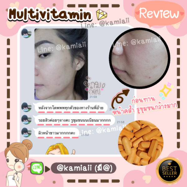 🍊วิตามินรองพื้นหน้าเงา Multivitamin ลดสิว หลุมสิว เร่งผิวขาวใส - Image 6