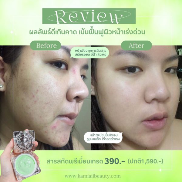 ✨Pro‼️ ครีมคริสตัลรกแอปเปิ้ลสเต็มเซลล์ ครีมพรีเมี่ยมสลายฝ้ากระ หน้าขาวใส รักษาผิวหน้าเร่งด่วน - Image 6