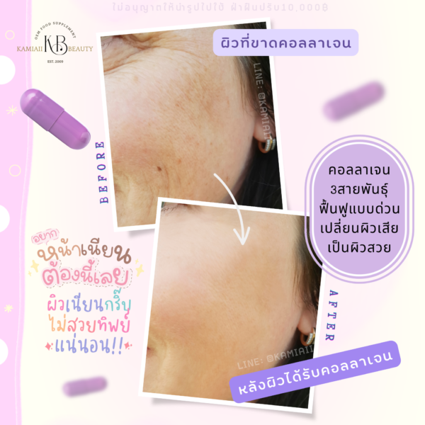 คอลลาเจนตัวแรงเข้มข้น บูสผิวใสหน้าใสเด้งเร่งด่วน คอลลาเจนม่วง The New Collagen - Image 2