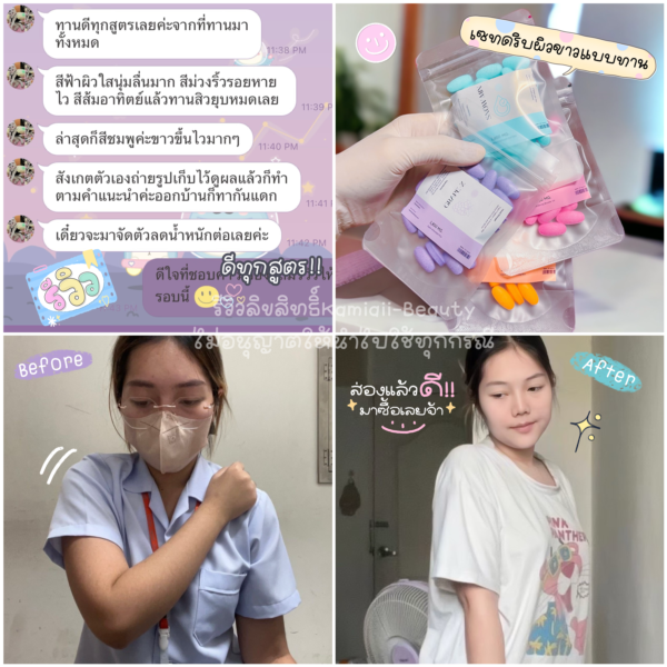 เซทรวมอนุพันธุ์ผิวขาว ครบจบทุกปัญหา สำหรับคนขาวยากดื้อยา กู้ผิวเสียหนัก Multi White Vita Set - Image 5