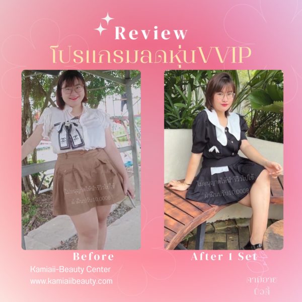🇰🇷โปรแกรมVVIP ลดดื้อยาขั้นสุดท้าย (มีฉลาก) สูตรจากโรงพยาบาลเกาหลี แถมฟรีตัวลดก่อนนอน มีจำกัด10เซท - Image 4