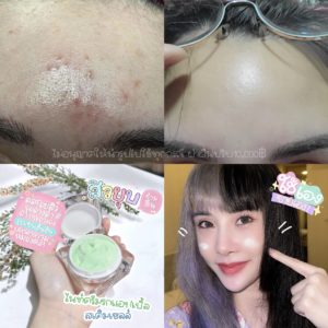 ✨Pro‼️ ครีมคริสตัลรกแอปเปิ้ลสเต็มเซลล์ ครีมพรีเมี่ยมสลายฝ้ากระ หน้าขาวใส รักษาผิวหน้าเร่งด่วน