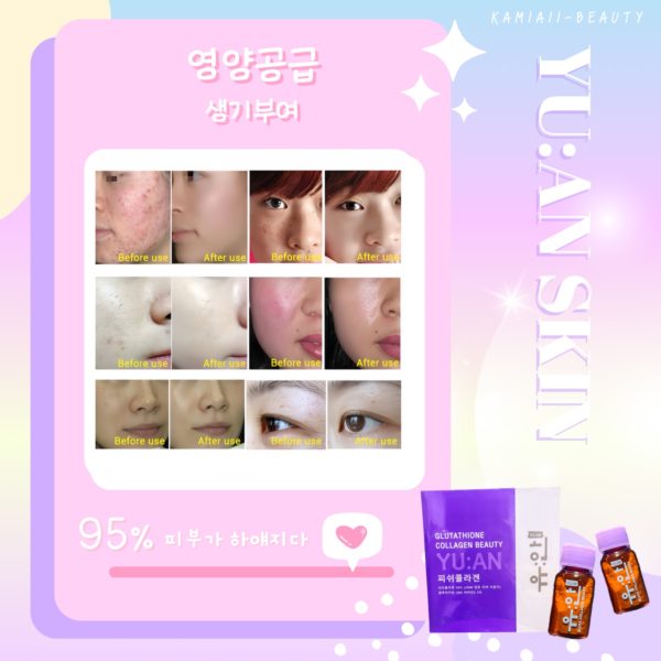 💟โปรด่วน 1แถม1 🇰🇷กลูต้าช็อตดริปผิวแบบกินของคลินิกผิวเกาหลี ลดเม็ดสีผิวเข้มได้60เท่า ขาวเงาขีดสุด - Image 16