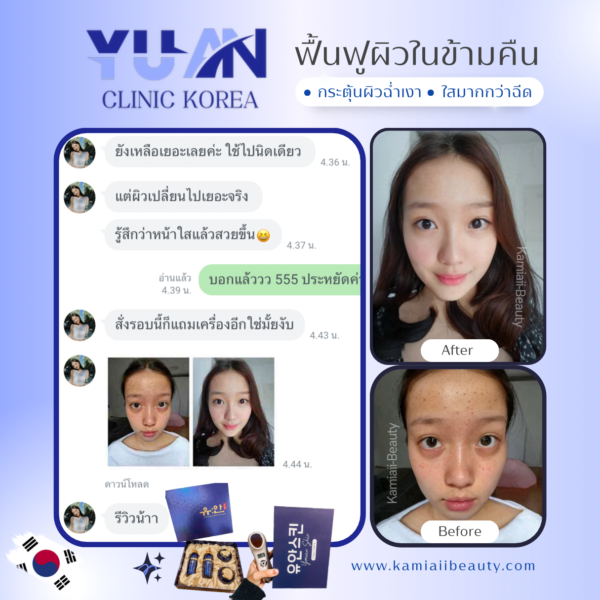 🇰🇷โปรด่วน1แถม1 🔥เซทสกินแคร์หรูคลินิกผิวเกาหลี + แถมเครื่องทรีทเม้นท์หน้าของคลินิก คืนชีพผิวไวมาก - Image 13