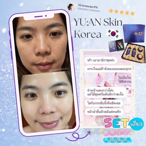 🇰🇷โปรด่วน1แถม1 🔥เซทสกินแคร์หรูคลินิกผิวเกาหลี + แถมเครื่องทรีทเม้นท์หน้าของคลินิก คืนชีพผิวไวมาก - Image 15