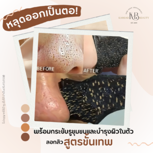 ขั้นต่ำ1แผ่น🔥 แผ่นลอกสิวเสี้ยนขั้นเทพ ตัวผลิตให้แบรนด์ใหญ่ ลดความมัน สิวหลุดไม่ขึ้นใหม่ ลดรูขุมขน