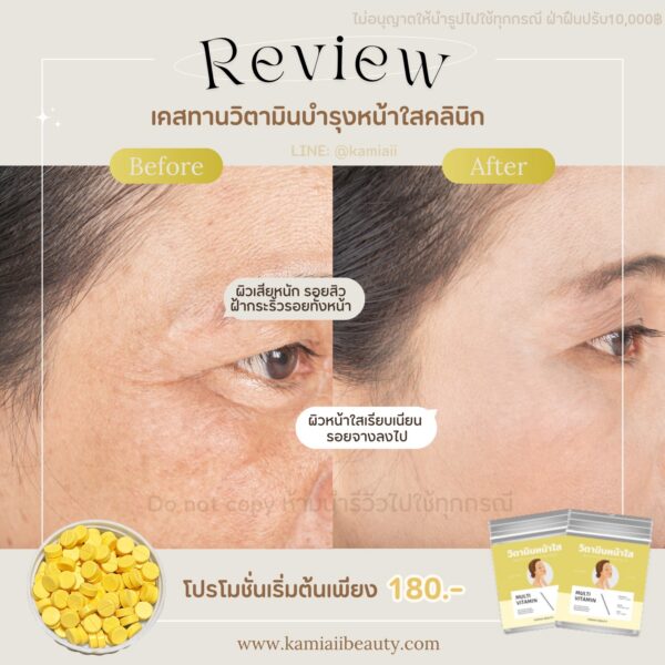 ⭐️ วิตามินหน้าใสDC  บำรุงผิวขาว ผิวหน้าเรียบเนียน ลดเอฟเฟกต์ บำรุงร่างกาย เหลืองกลม - Image 3