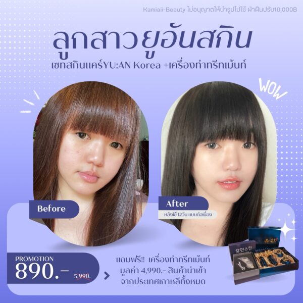 🇰🇷โปรด่วน1แถม1 🔥เซทสกินแคร์หรูคลินิกผิวเกาหลี + แถมเครื่องทรีทเม้นท์หน้าของคลินิก คืนชีพผิวไวมาก - Image 12