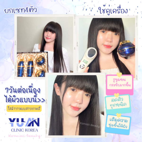 🇰🇷โปรด่วน1แถม1 🔥เซทสกินแคร์หรูคลินิกผิวเกาหลี + แถมเครื่องทรีทเม้นท์หน้าของคลินิก คืนชีพผิวไวมาก - Image 3