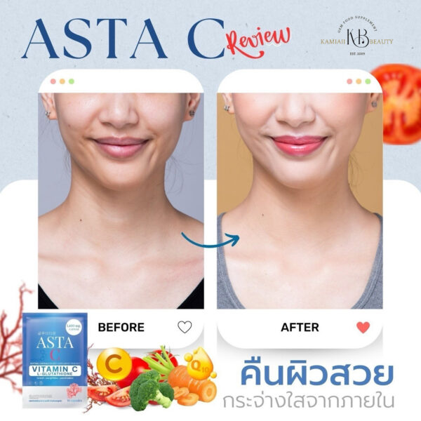 💙โปร1แถม1 กลูต้าซอฟเจลบลูโอเชี่ยน Asta-C 1,400mg. ขาวซีดออร่า ผิวขาวขั้นสุด นำเข้าจากเกาหลีสำหรับคนผิวคล้ำปานกลางถึงมาก - Image 8