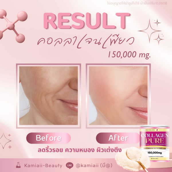 🇯🇵Pure Super Collagen 150,000mg. คอลลาเจนบริสุทธิ์แบบเข้มข้นปริมาณสูงนำเข้าจากญี่ปุ่น - Image 3