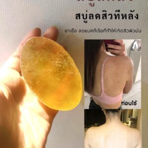 [TESTER] สบู่ดูแลเรื่องสิว คุมมัน สารสกัดเสถียร ลดแบคทีเรีย เคลียร์ผิวใสเรียบเนียน  ใช้ได้ทั้งหน้าและตัว อ่อนโยนไม่ระคายเคือง AC DOCTOR SOAP